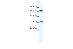 KCNN1 Rabbit anti-Human, Polyclonal, Novus Biologicals 0.1ml; Unconjugated:Antibodies,